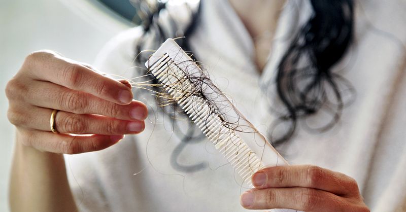 Veroorzaakt Het Spiraaltje Van Mirena Haarverlies Conditie Specifiek Klinisch Tips En Nuttige Informatie Over Uw Gezondheid